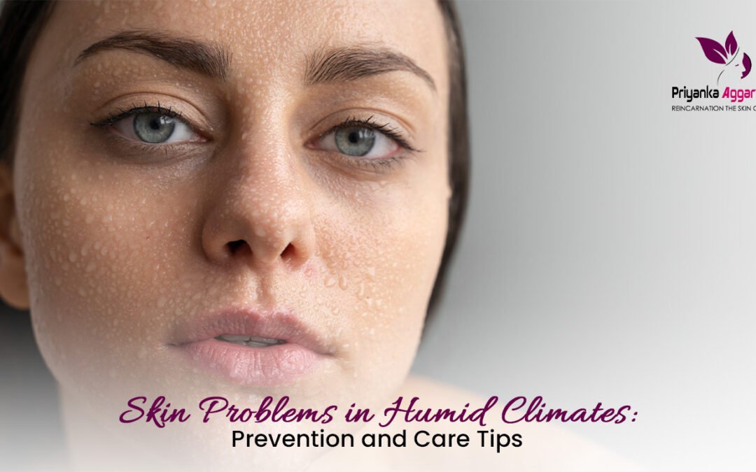 Skin Problems in Humid Climates: Your Guide to Happy, Healthy Skin!