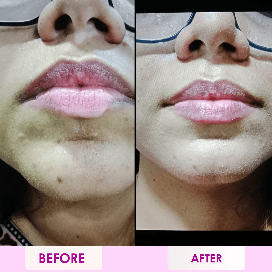 dr-priyanka-website-images-7-1 (1)